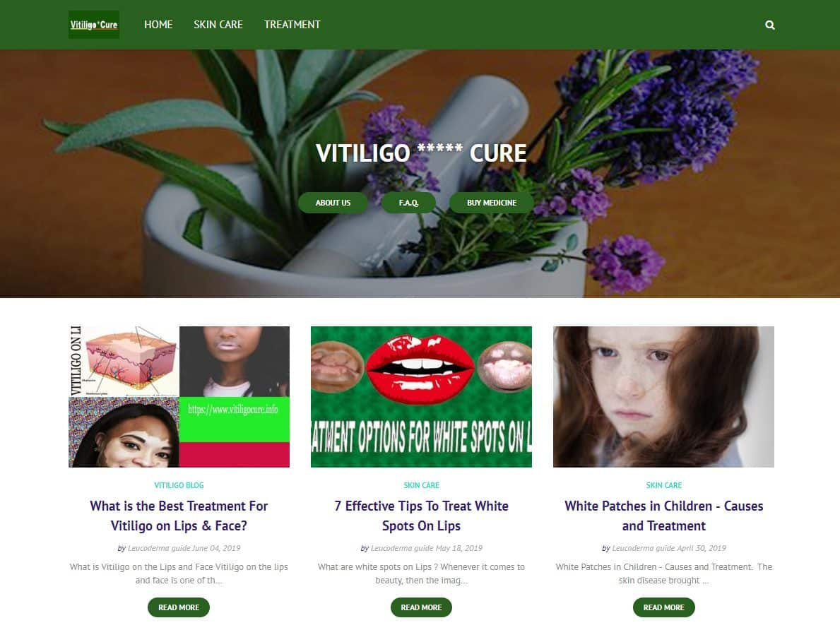 Screenshot of the Vitiligo Cure website